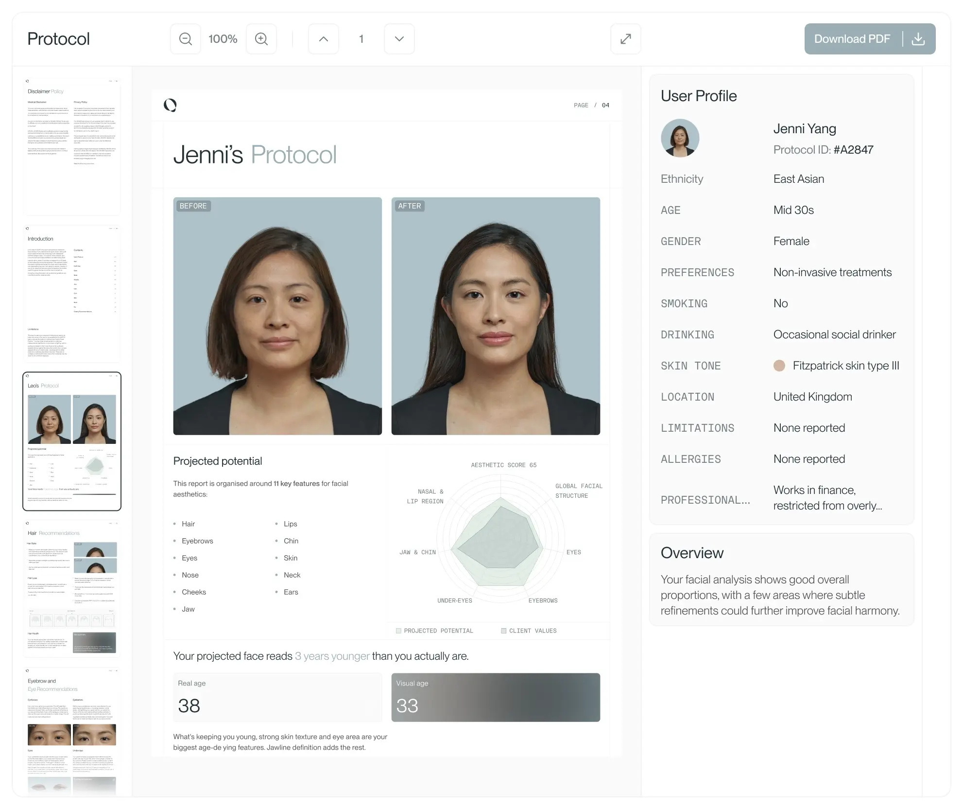 Aurii personalised report interface preview